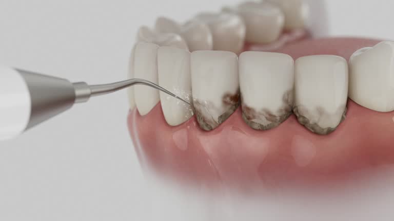 Trusted Root Canal Treatment service in Elmore, OH - Dentist Open Now